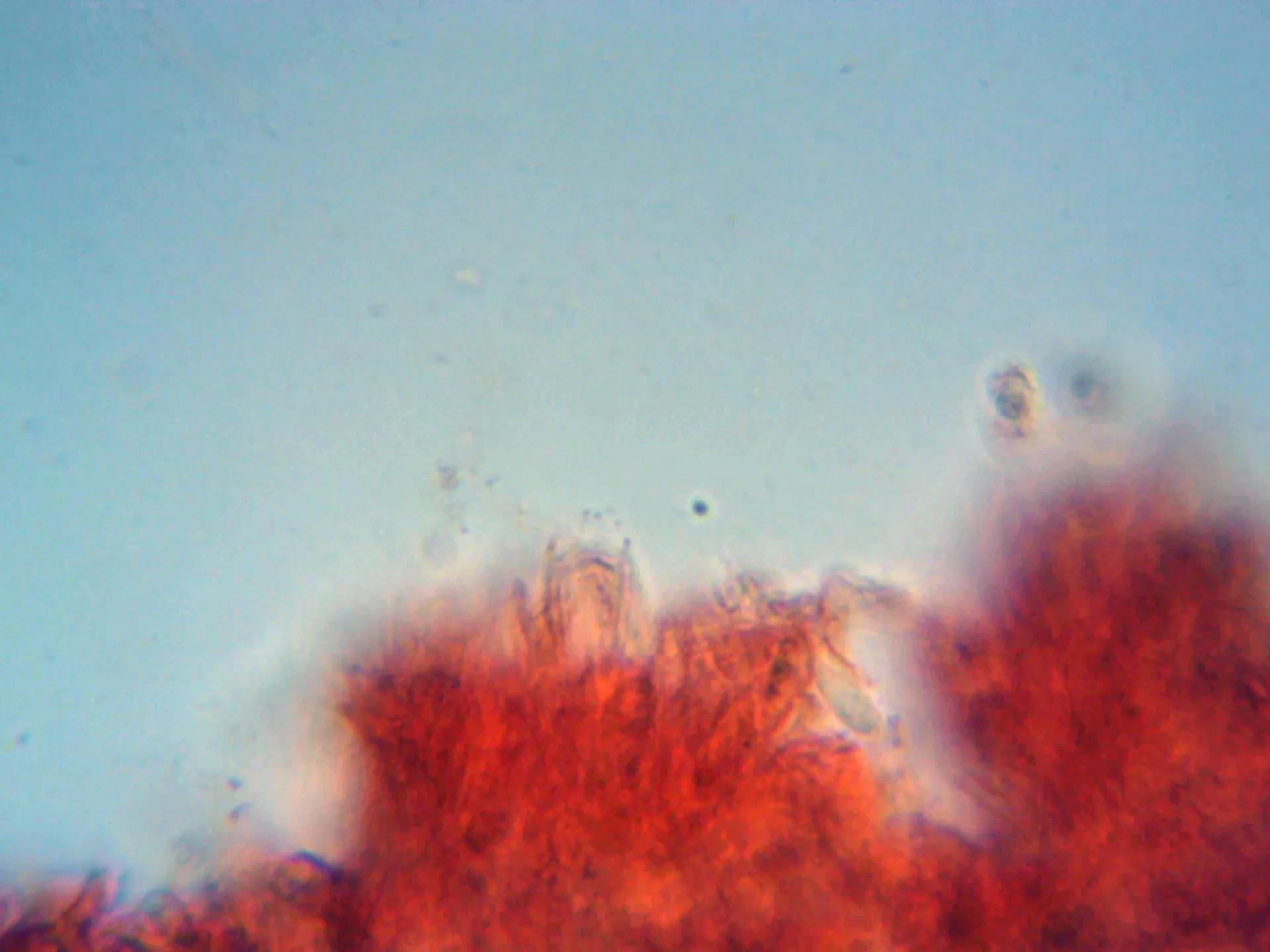 Microscopía de Neofavolus alveolaris - 10 - Basidio tetrasporico 3
